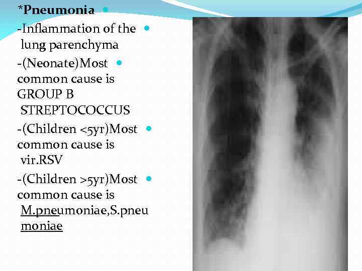*Pneumonia -Inflammation of the lung parenchyma -(Neonate)Most common cause is GROUP B STREPTOCOCCUS -(Children