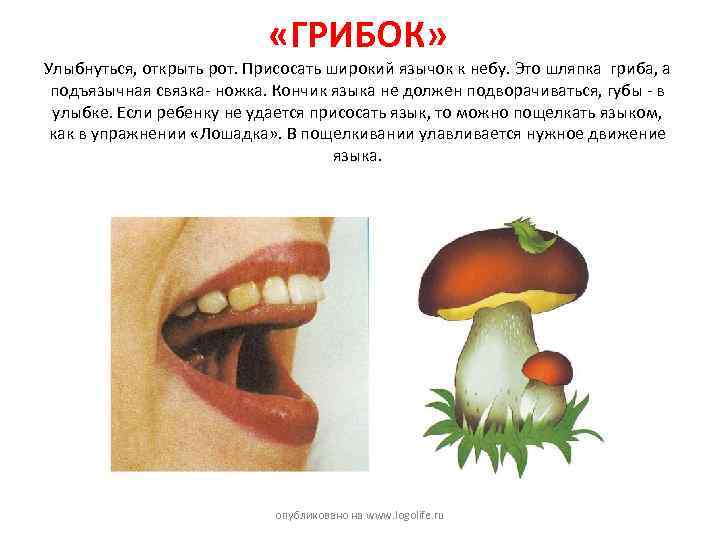  «ГРИБОК» Улыбнуться, открыть рот. Присосать широкий язычок к небу. Это шляпка гриба, а