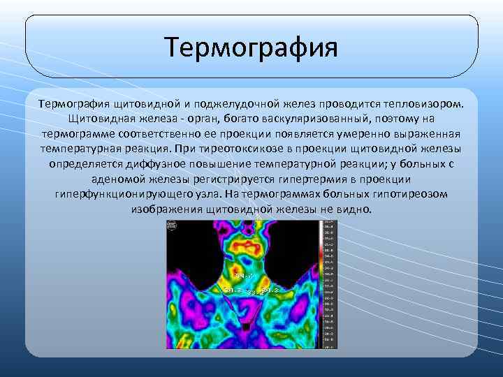 Термография щитовидной и поджелудочной желез проводится тепловизором. Щитовидная железа - орган, богато васкуляризованный, поэтому