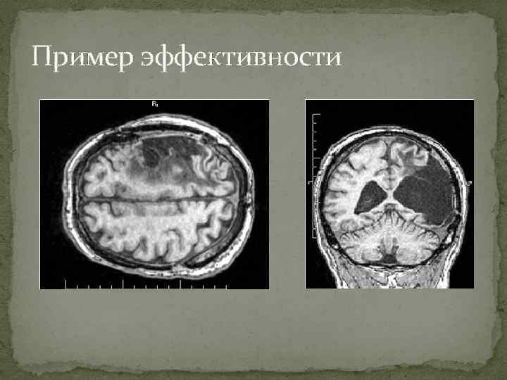 Пример эффективности 