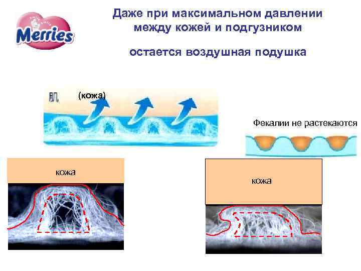 Даже при максимальном давлении между кожей и подгузником остается воздушная подушка (кожа) Фекалии не