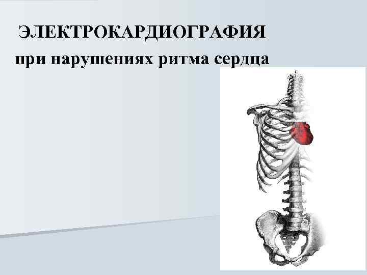 ЭЛЕКТРОКАРДИОГРАФИЯ при нарушениях ритма сердца 