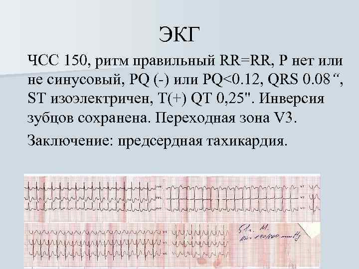 ЭКГ ЧСС 150, ритм правильный RR=RR, Р нет или не синусовый, PQ (-) или