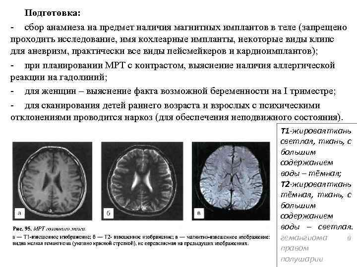 Подготовка: - сбор анамнеза на предмет наличия магнитных имплантов в теле (запрещено проходить исследование,