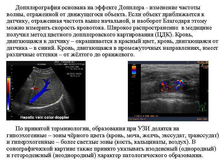 Допплерография основана на эффекте Допплера - изменение частоты волны, отраженной от движущегося объекта. Если