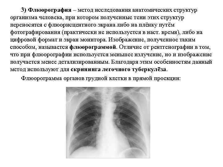 3) Флюорография – метод исследования анатомических структур организма человека, при котором полученные тени этих