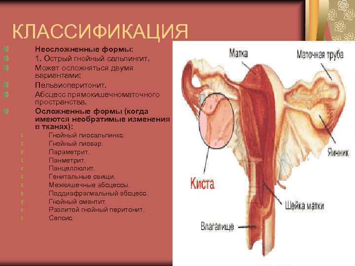 КЛАССИФИКАЦИЯ Неосложненные формы: 1. Острый гнойный сальпингит. Может осложняться двумя вариантами: Пельвиоперитонит. Абсцесс прямокишечноматочного