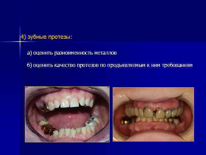 4) зубные протезы: а) оценить разноименность металлов б) оценить качество протезов по предъявляемым к