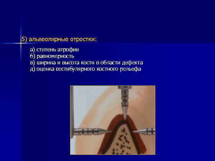 5) альвеолярные отростки: а) степень атрофии б) равномерность в) ширина и высота кости в