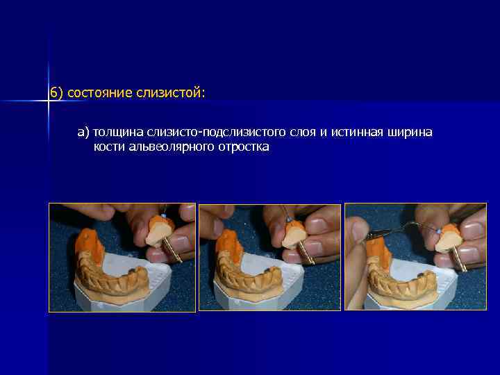 6) состояние слизистой: а) толщина слизисто-подслизистого слоя и истинная ширина кости альвеолярного отростка 