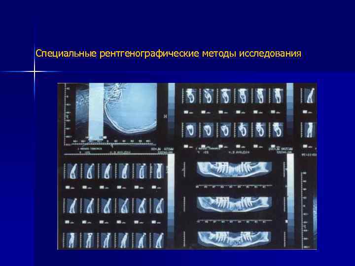 Специальные рентгенографические методы исследования 