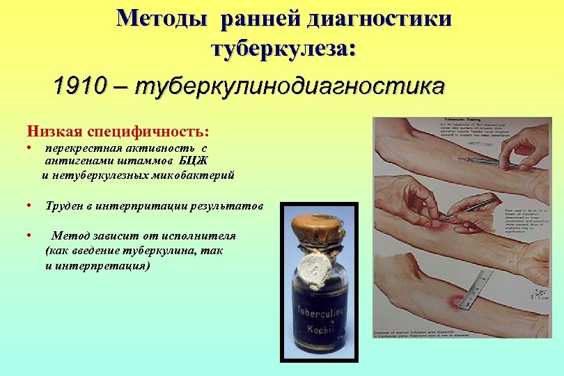 Методы ранней диагностики туберкулеза: 1910 – туберкулинодиагностика Низкая специфичность: • перекрестная активность с антигенами