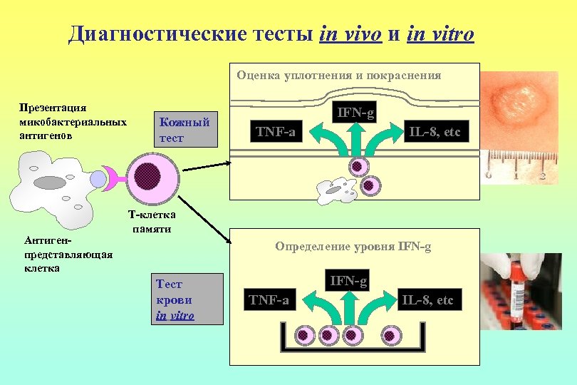 Диагностические тесты in vivo и in vitro Оценка уплотнения и покраснения Презентация микобактериальных антигенов