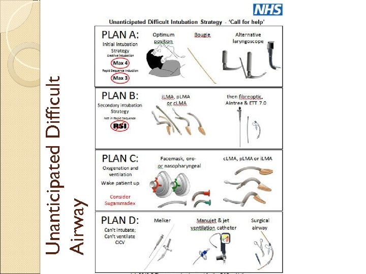 Unanticipated Difficult Airway 