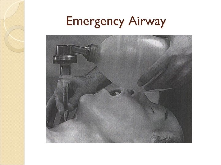 Emergency Airway 