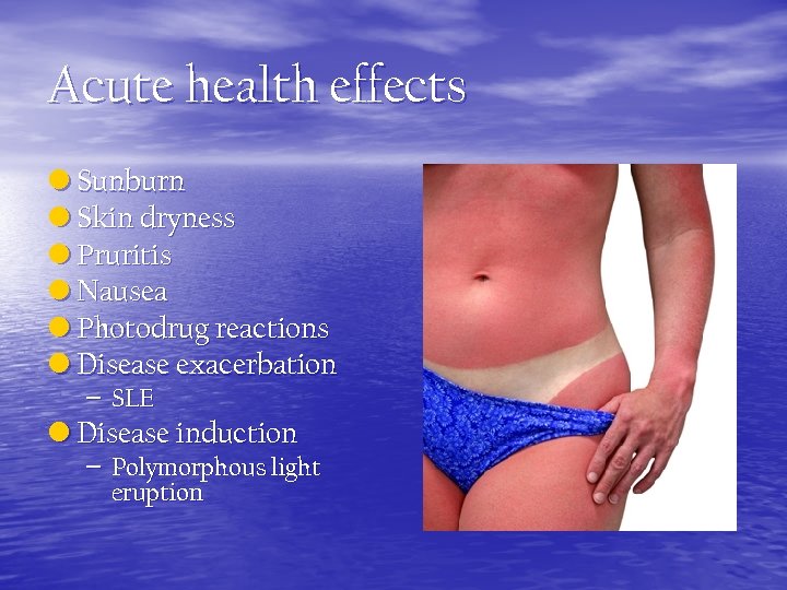 Acute health effects • Sunburn • Skin dryness • Pruritis • Nausea • Photodrug