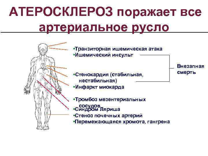 При атеросклерозе поражаются