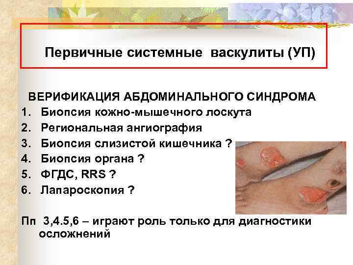 Первичные системные васкулиты (УП) ВЕРИФИКАЦИЯ АБДОМИНАЛЬНОГО СИНДРОМА 1. Биопсия кожно-мышечного лоскута 2. Региональная ангиография