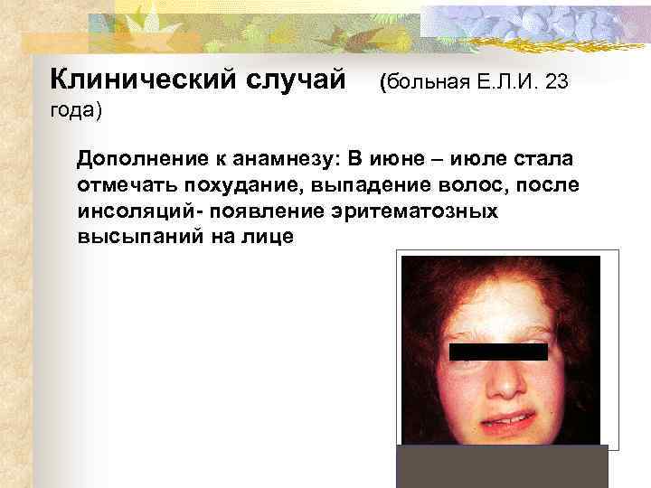Клинический случай (больная Е. Л. И. 23 года) Дополнение к анамнезу: В июне –