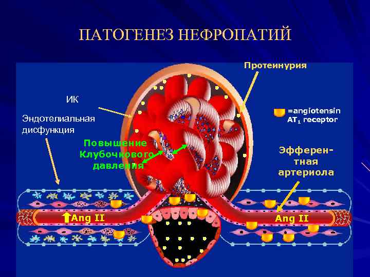 ПАТОГЕНЕЗ НЕФРОПАТИЙ Протеинурия ИК Эндотелиальная дисфункция Повышение Клубочкового давления Ang II =angiotensin AT 1