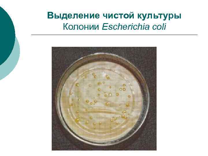 Выделение чистой культуры Колонии Escherichia coli 