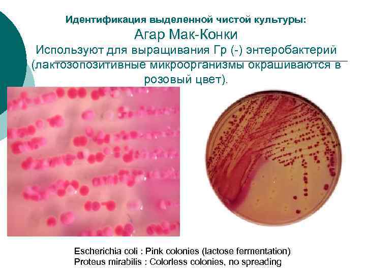 Идентификация выделенной чистой культуры: Агар Мак-Конки Используют для выращивания Гр (-) энтеробактерий (лактозопозитивные микроорганизмы