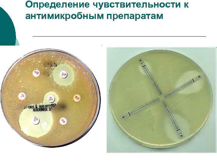 Определение чувствительности к антимикробным препаратам 