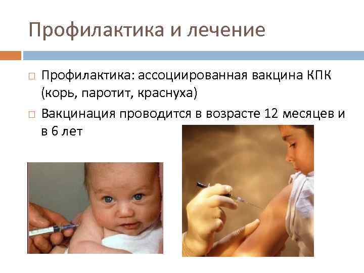 Прививка корь краснуха паротит когда делают детям