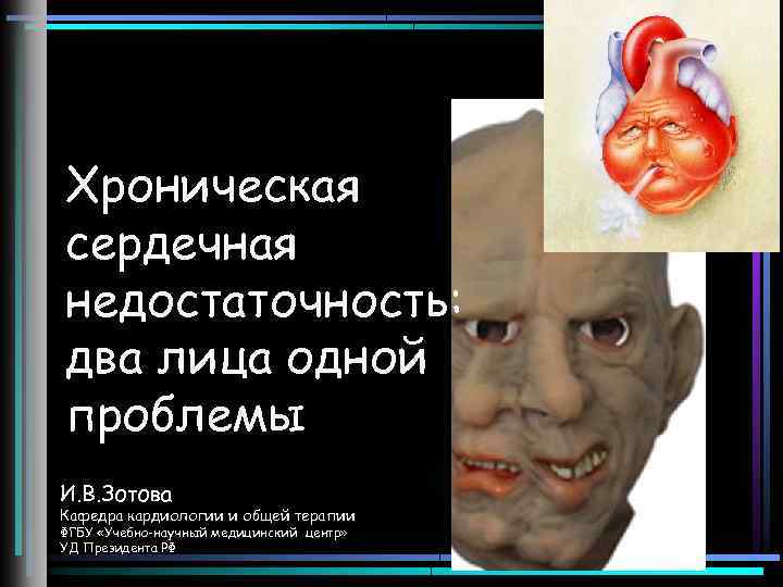 Хроническая сердечная недостаточность: два лица одной проблемы И. В. Зотова Кафедра кардиологии и общей