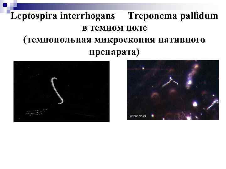 Leptospira interrhogans Treponema pallidum в темном поле (темнопольная микроскопия нативного препарата) 