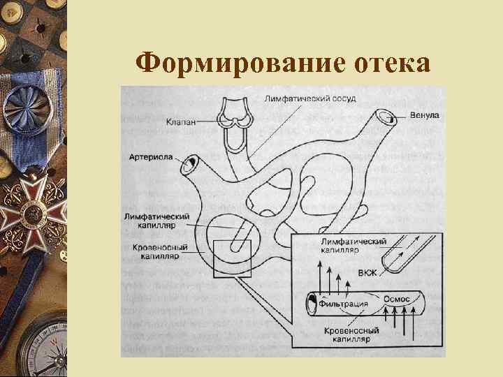 Формирование отека 