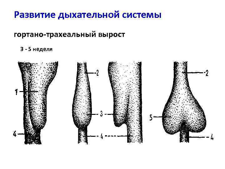 Бифуркация трахеи карина