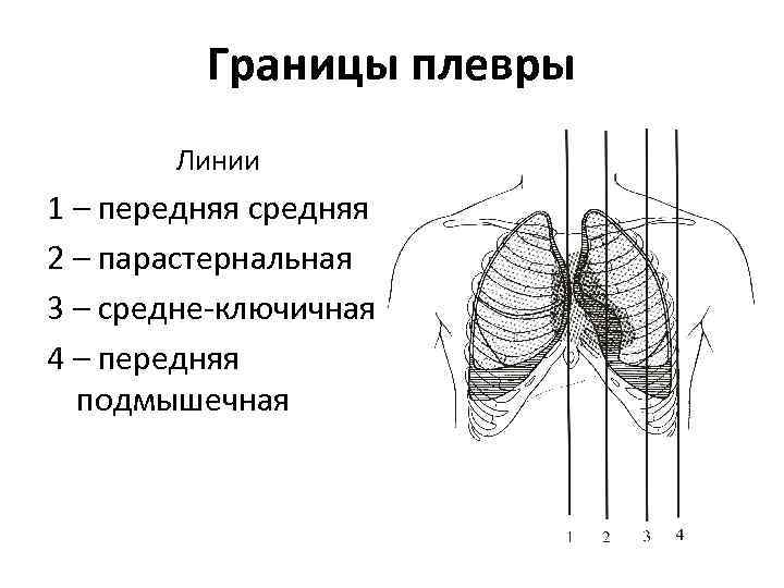 Парастернальная линия это