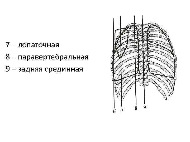 7 – лопаточная 8 – паравертебральная 9 – задняя срединная 