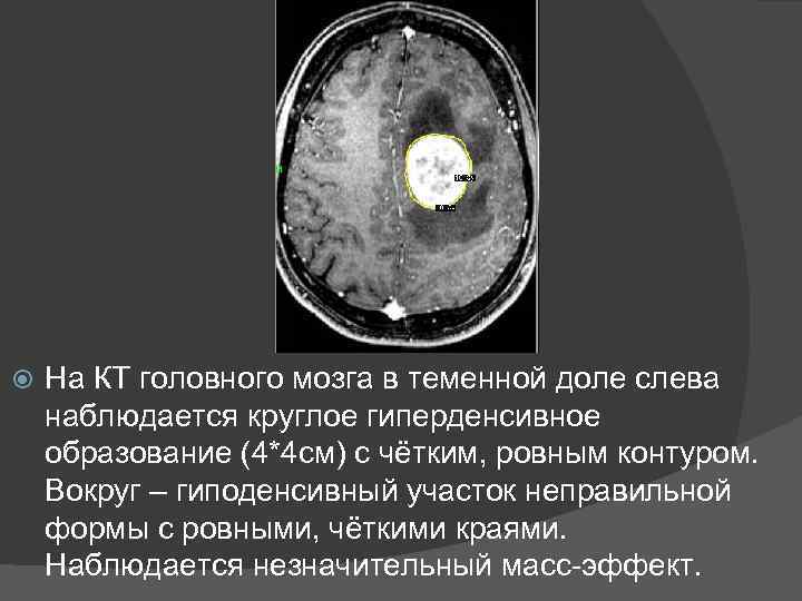 Образование округлой формы с четкими ровными контурами