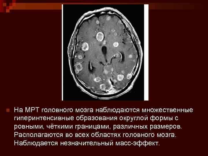 Образование округлой формы с четкими ровными контурами