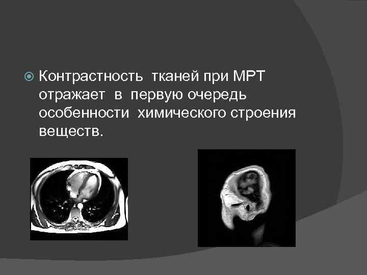  Контрастность тканей при МРТ отражает в первую очередь особенности химического строения веществ. 