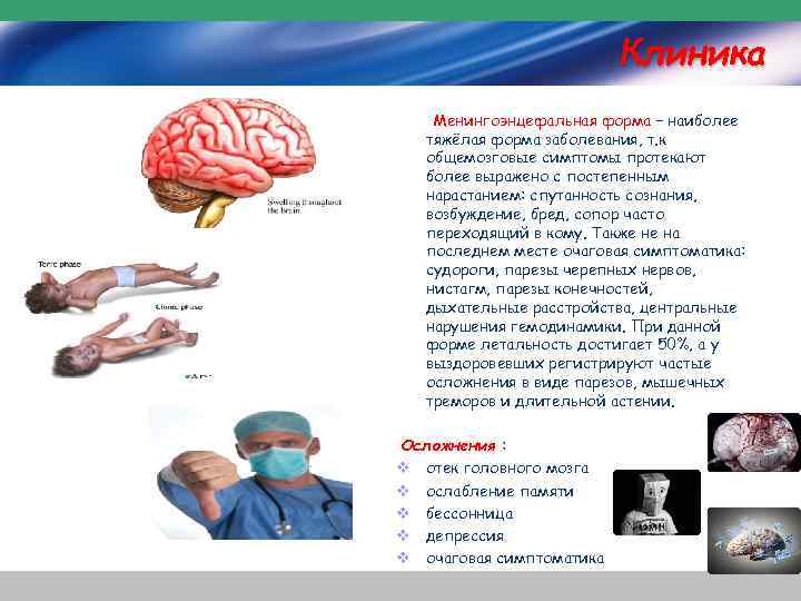 Клиника Менингоэнцефальная форма – наиболее тяжёлая форма заболевания, т. к общемозговые симптомы протекают более