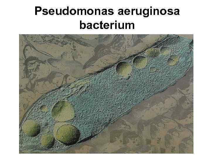 Pseudomonas aeruginosa bacterium 