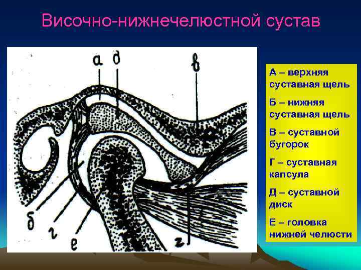 Височно-нижнечелюстной сустав А – верхняя суставная щель Б – нижняя суставная щель В –