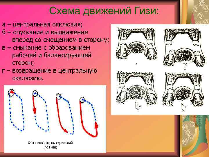 Схема движений Гизи: а – центральная окклюзия; б – опускание и выдвижение вперед со