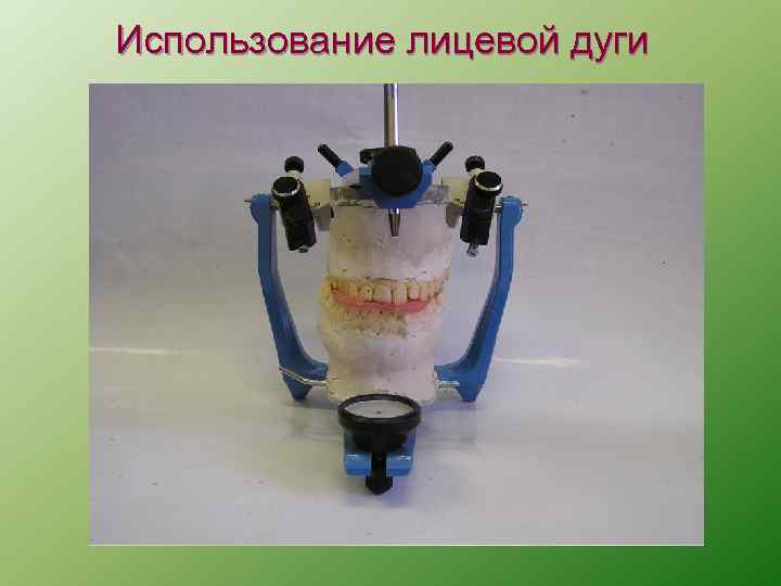 Использование лицевой дуги 