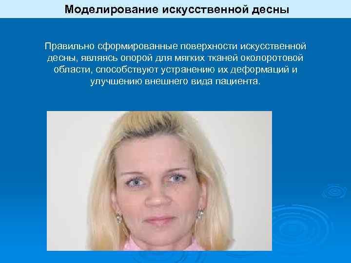  Моделирование искусственной десны Правильно сформированные поверхности искусственной десны, являясь опорой для мягких тканей