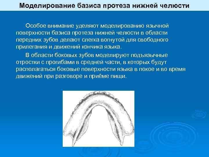 Моделирование базисов протезов