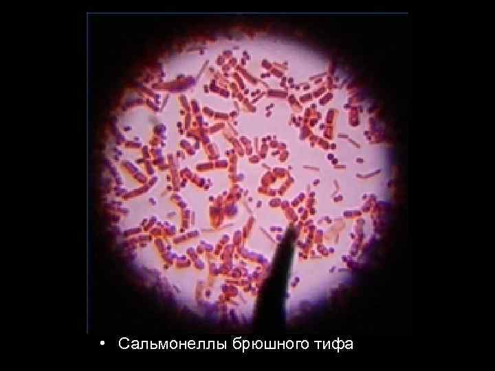  • Сальмонеллы брюшного тифа 