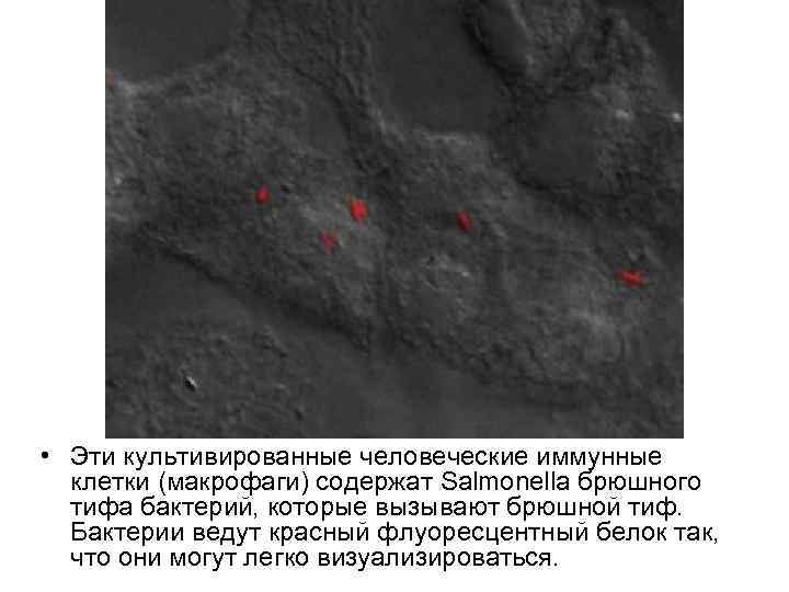  • Эти культивированные человеческие иммунные клетки (макрофаги) содержат Salmonella брюшного тифа бактерий, которые