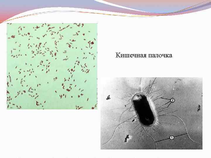 Кишечная палочка 