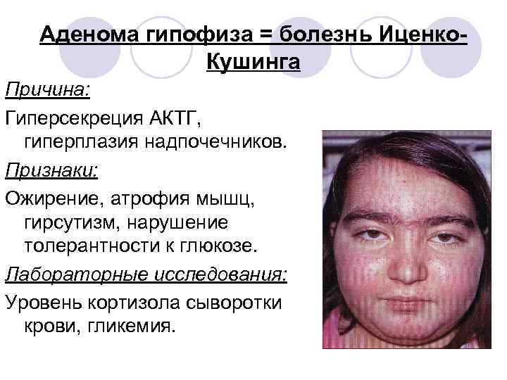 Аденома гипофиза = болезнь Иценко. Кушинга Причина: Гиперсекреция АКТГ, гиперплазия надпочечников. Признаки: Ожирение, атрофия