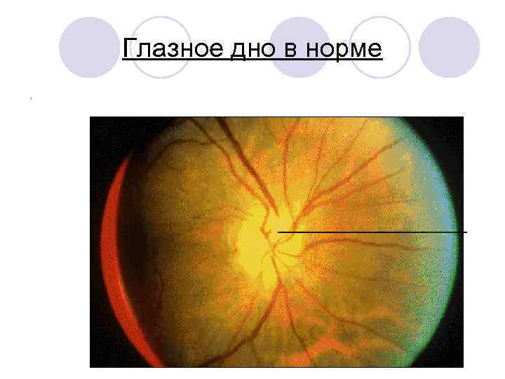 Глазное дно в норме. 