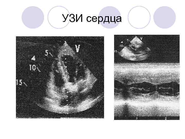 УЗИ сердца 3 1 